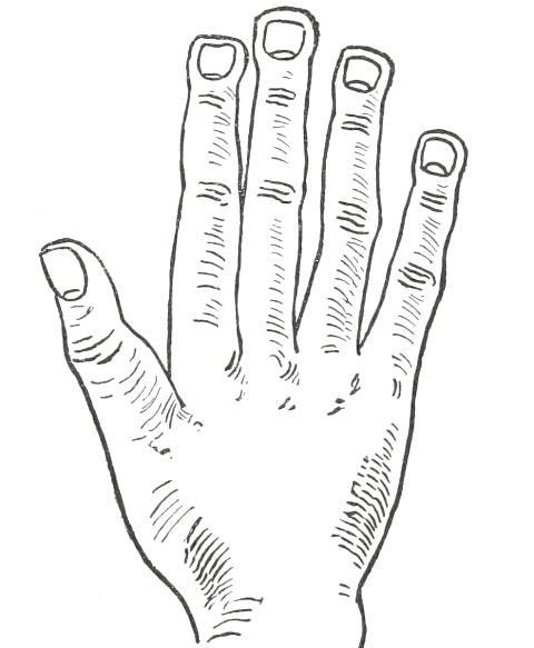 Fig. 23

SPATULATE HAND