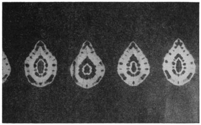 A linear tear-drop pattern