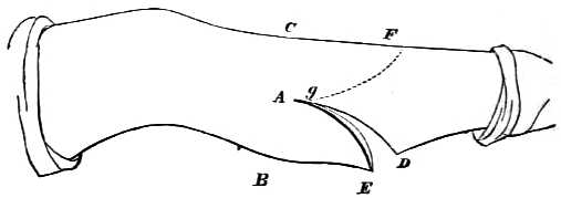 Illustration showing where to make incisions on leg.