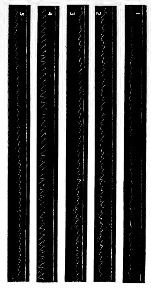 Chart of Sphygmographic Tracings