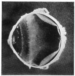 cross-section of eye