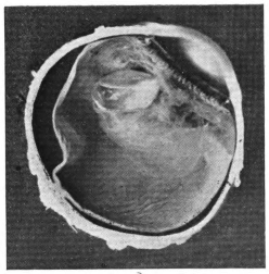 cross-section of eye