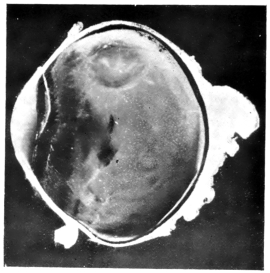 cross-section of eye