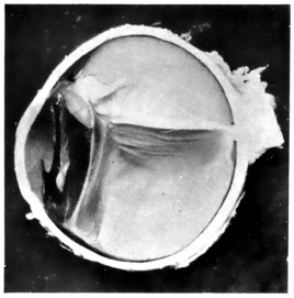 cross-section of eye