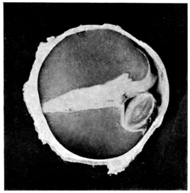 cross-section of eye