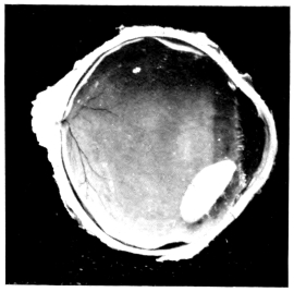 cross-section of eye