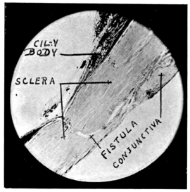 cross-section of eye