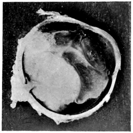 cross-section of eye