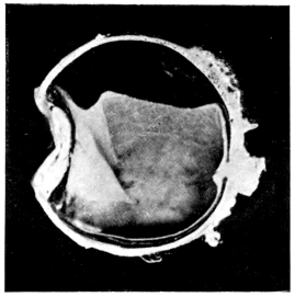 cross-section of eye