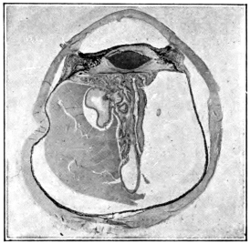 cross-section of eye