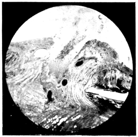 cross-section of eye