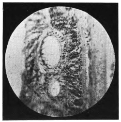 cross-section of eye