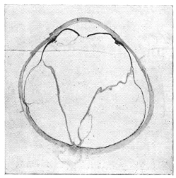 cross-section of eye